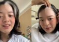 5 Fakta Wanita Penderita Vitiligo Setelah Lakukan Pemutihan Rambut